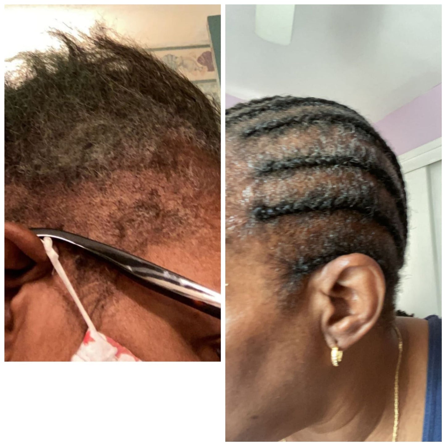 WHOLESALE-HAIR CARE-PRIVATE LABELS- (4 Gallons)  SHAMPOO-CONDITIONER- Hair GROWTH OIL-GROWTH SERUM-with Peppermint Oil, Tea Tree Oil, Argan oil, Jojoba seed, Avocado oil, Castor oil, Sweet Almond, Vitamin E Oil for Scalp and Hair