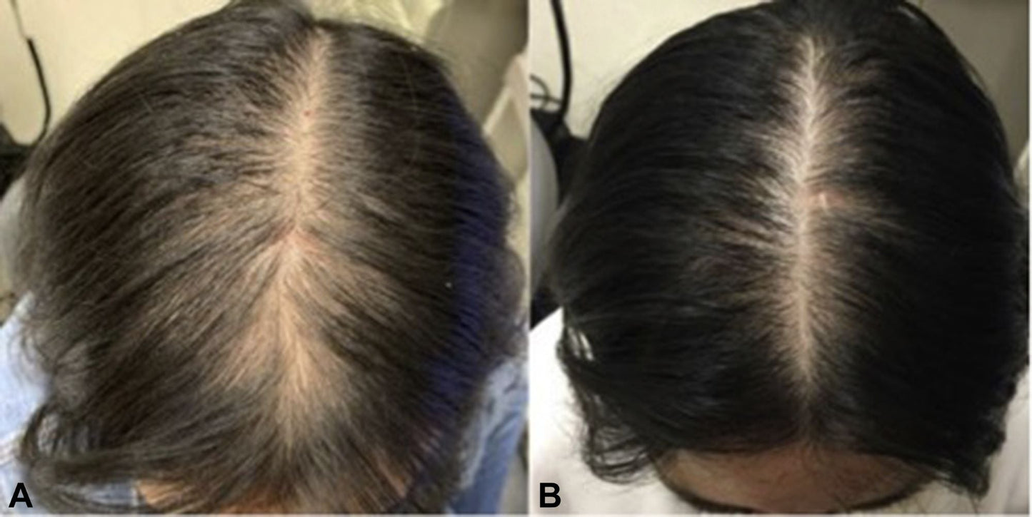 WHOLESALE-HAIR CARE-PRIVATE LABELS- (4 Gallons)  SHAMPOO-CONDITIONER- Hair GROWTH OIL-GROWTH SERUM-with Peppermint Oil, Tea Tree Oil, Argan oil, Jojoba seed, Avocado oil, Castor oil, Sweet Almond, Vitamin E Oil for Scalp and Hair